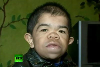 ชายตัวเตี้ยที่สุดในโลก