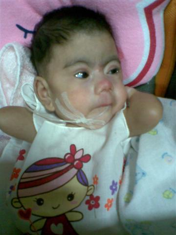 น้องโมเน่ต์