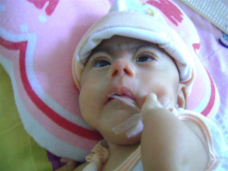 น้องโมเน่ต์