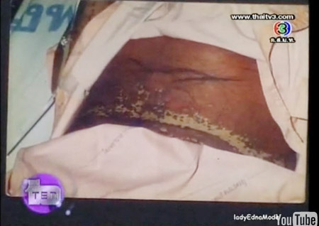 วรรณา สว่างโชติ แพ้ยาหน้าเป็นศพ แต่ผ่านมาได้เพราะรักจากสามี