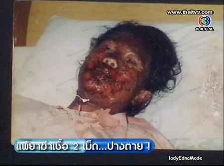 วรรณา สว่างโชติ แพ้ยาหน้าเป็นศพ แต่ผ่านมาได้เพราะรักจากสามี