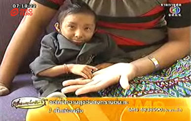 ชายตัวเล็กที่สุดในโลก มาลี ดวงดี