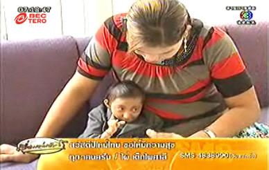 ชายตัวเล็กที่สุดในโลก มาลี ดวงดี