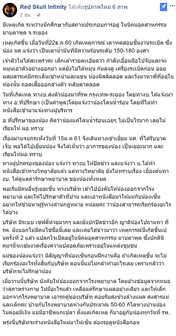 เตาโรงงานระเบิดใส่ นศ. เตาโรงงานระเบิดใส่ นศ.