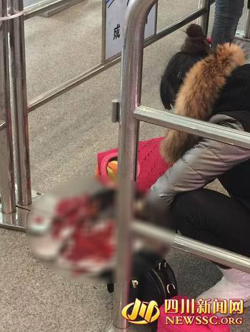 ปาดคอเป็ดประชดห้ามนำขึ้นรถไฟฟ้าใต้ดิน