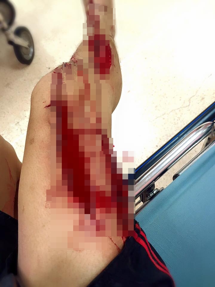 หนุ่มตกท่อ