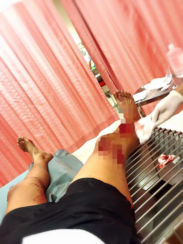 หนุ่มตกท่อ