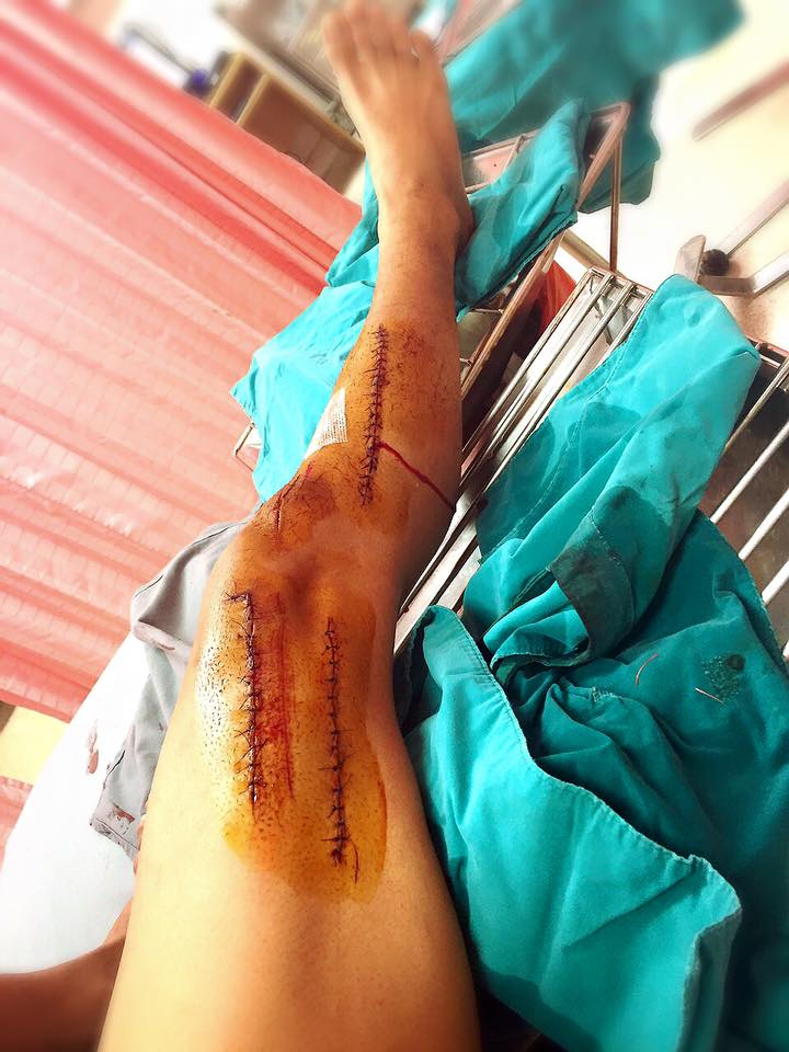 หนุ่มตกท่อ