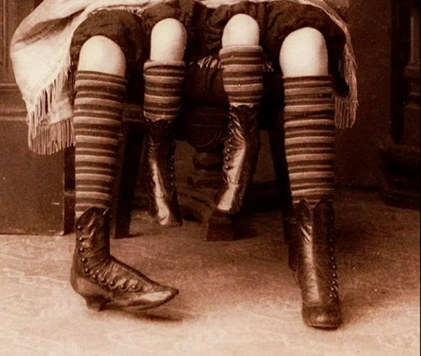 เมอร์เทิล คอร์บิน มนุษย์ 4 ขาที่มีอยู่จริงในประวัติศาสตร์