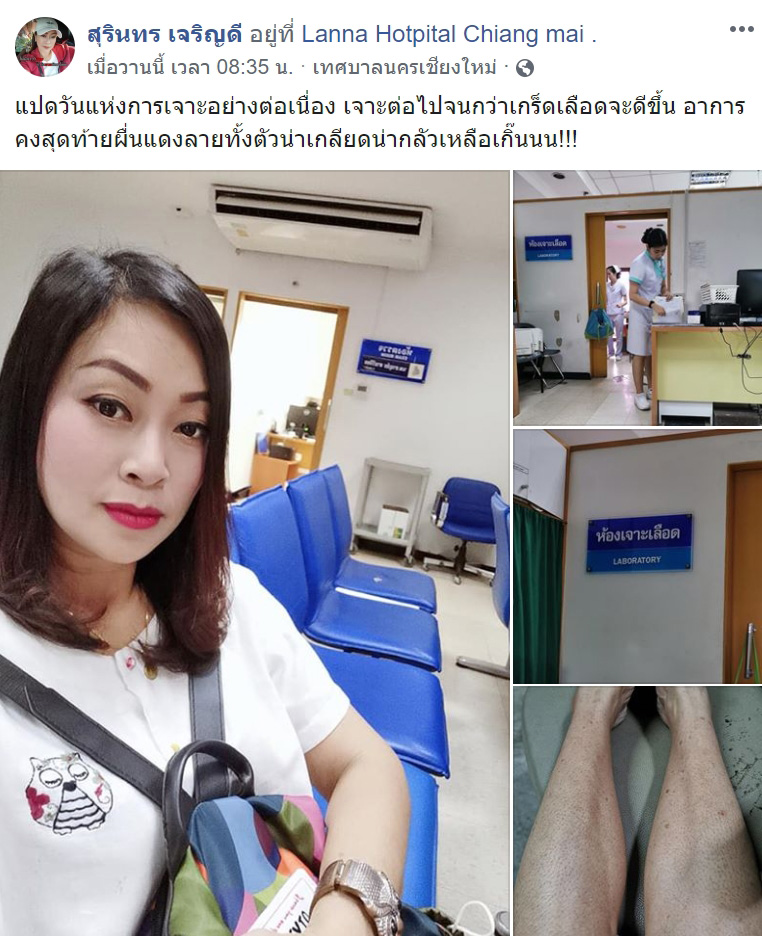 ไข้เลือดออก ไข้เลือดออก