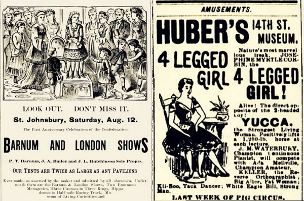 เมอร์เทิล คอร์บิน มนุษย์ 4 ขาที่มีอยู่จริงในประวัติศาสตร์