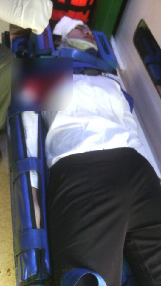 บิ๊กไบค์ชนน้องลิ้นจี่ บิ๊กไบค์ชนน้องลิ้นจี่