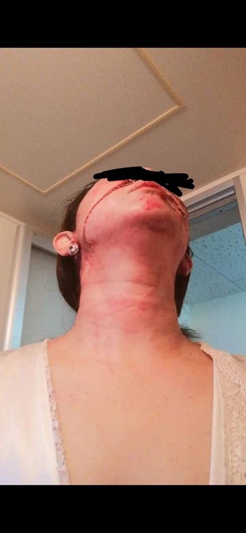 คนไทยถูกทำร้ายที่ญี่ปุ่น คนไทยถูกทำร้ายที่ญี่ปุ่น