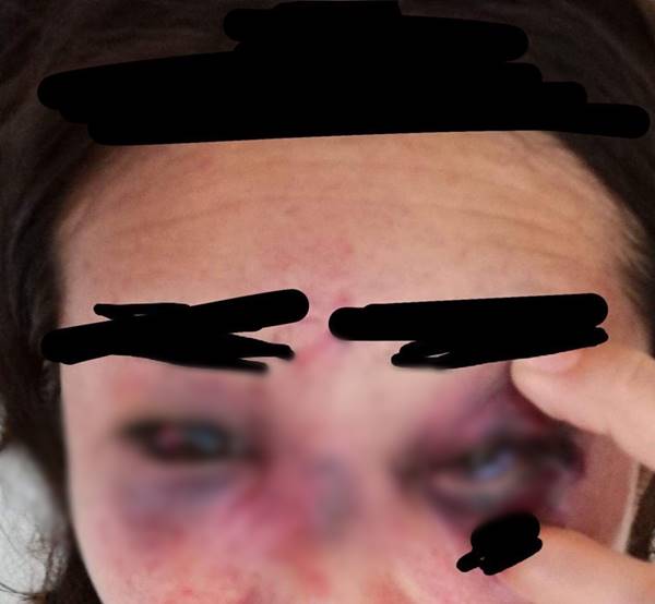 คนไทยถูกทำร้ายที่ญี่ปุ่น คนไทยถูกทำร้ายที่ญี่ปุ่น