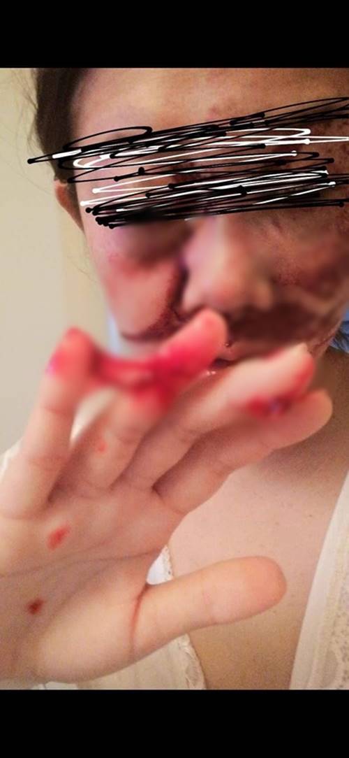 คนไทยถูกทำร้ายที่ญี่ปุ่น คนไทยถูกทำร้ายที่ญี่ปุ่น