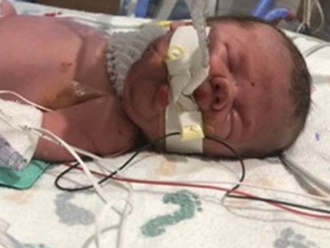 เด็กแรกเกิด เด็กแรกเกิด