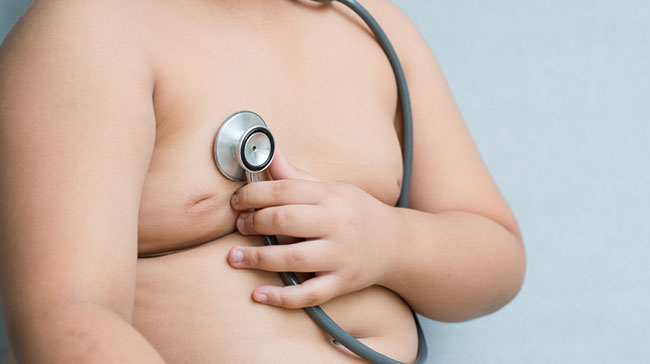 ปัญหาอ้วน ปัญหาอ้วน