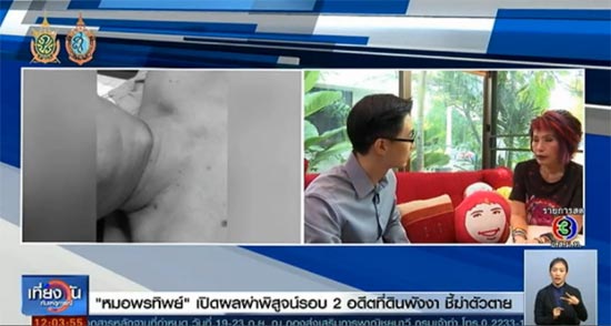 หมอพรทิพย์ เผยผลผ่าพิสูจน์ รอบ 2 ยัน ธวัชชัย อนุกูล อดีตที่ดินพังงา แขวนคอดับเอง หมอพรทิพย์ เผยผลผ่าพิสูจน์ รอบ 2 ยัน ธวัชชัย อนุกูล อดีตที่ดินพังงา แขวนคอดับเองหมอพรทิพย์ เผยผลผ่าพิสูจน์ รอบ 2 ยัน ธวัชชัย อนุกูล อดีตที่ดินพังงา แขวนคอดับเอง