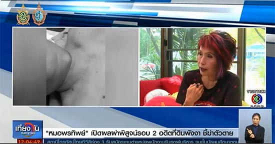 หมอพรทิพย์ เผยผลผ่าพิสูจน์ รอบ 2 ยัน ธวัชชัย อนุกูล อดีตที่ดินพังงา แขวนคอดับเอง หมอพรทิพย์ เผยผลผ่าพิสูจน์ รอบ 2 ยัน ธวัชชัย อนุกูล อดีตที่ดินพังงา แขวนคอดับเอง