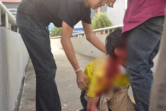 วิถีอาชีวะยกพวกตีกันป้ายรถเมล์ รังสิต คนหนีกระเจิง-สุดท้ายเลือดอาบ อาการร่อแร่ วิถีอาชีวะยกพวกตีกันป้ายรถเมล์ รังสิต คนหนีกระเจิง-สุดท้ายเลือดอาบ อาการร่อแร่