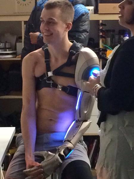 หนุ่มพิการเฮ ได้แขนเทียมสุดล้ำ ชาร์จมือถือ-ฉายไฟ-เป็นโดรนได้ด้วย !! หนุ่มพิการเฮ ได้แขนเทียมสุดล้ำ ชาร์จมือถือ-ฉายไฟ-เป็นโดรนได้ด้วย !!