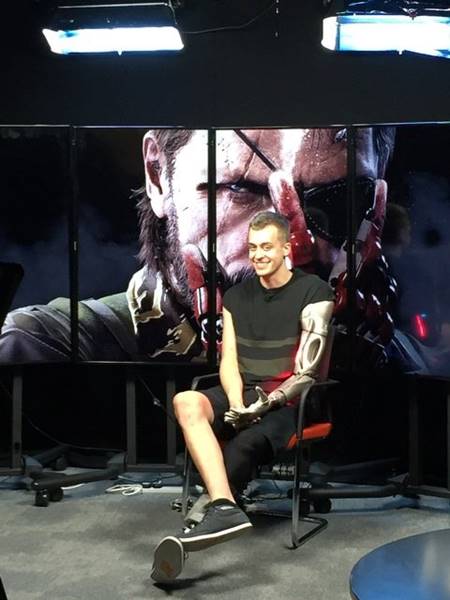 หนุ่มพิการเฮ ได้แขนเทียมสุดล้ำ ชาร์จมือถือ-ฉายไฟ-เป็นโดรนได้ด้วย !! หนุ่มพิการเฮ ได้แขนเทียมสุดล้ำ ชาร์จมือถือ-ฉายไฟ-เป็นโดรนได้ด้วย !!