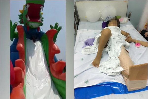 เล่นสไลเดอร์ที่สวนน้ำจนขาหัก เล่นสไลเดอร์ที่สวนน้ำจนขาหัก