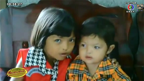 เด็กตาเพชร แพทย์แนะพาไปตรวจ คาดเกิดจากพันธุกรรม เด็กตาเพชร แพทย์แนะพาไปตรวจ คาดเกิดจากพันธุกรรม