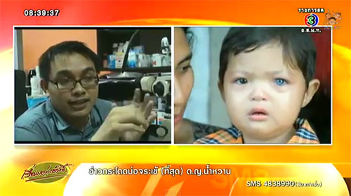 เด็กตาเพชร แพทย์แนะพาไปตรวจ คาดเกิดจากพันธุกรรม เด็กตาเพชร แพทย์แนะพาไปตรวจ คาดเกิดจากพันธุกรรม