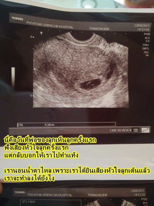 สาวตีแผ่ประสบการณ์สอนหญิงและติ่ง คบหนุ่มเกาหลี ทำชีวิตเปลี่ยนผัน สาวตีแผ่ประสบการณ์สอนหญิงและติ่ง คบหนุ่มเกาหลี ทำชีวิตเปลี่ยนผัน