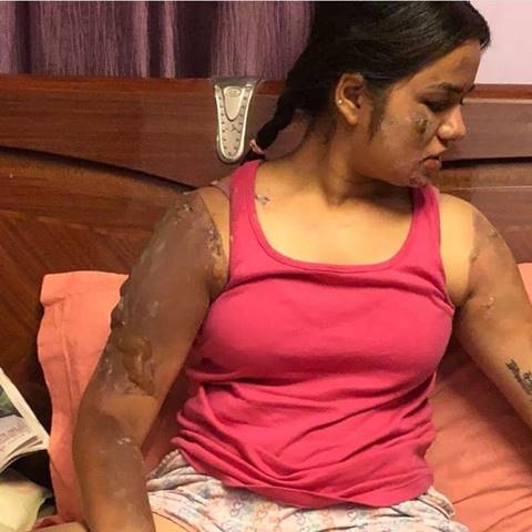 ลูกโป่งระเบิด ลูกโป่งระเบิด