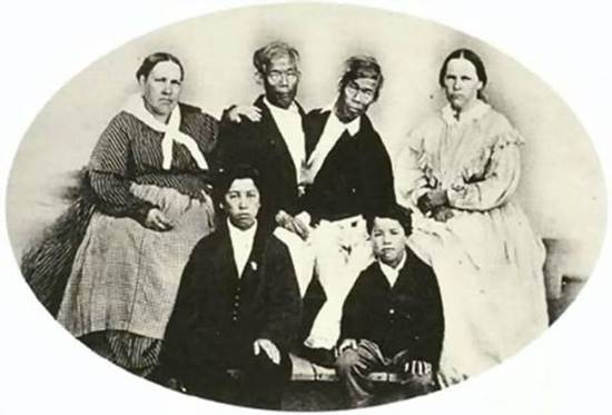 แฝดสยาม แฝดสยาม