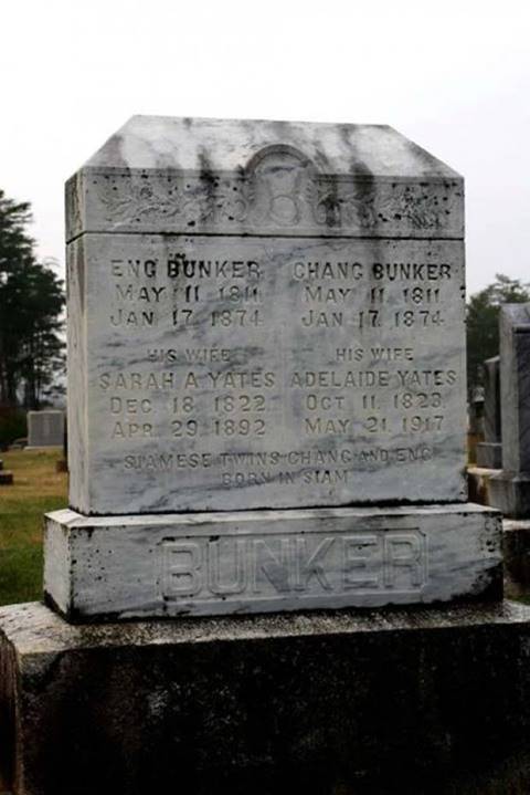 แฝดสยาม แฝดสยาม