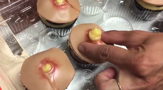 คัพเค้กหัวสิว คัพเค้กหัวสิว