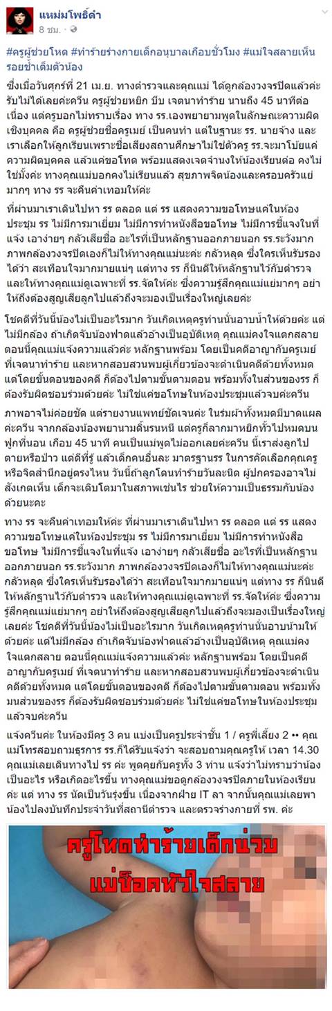 ครูพี่เลี้ยงใจมาร ทุบตีเด็กร่วมชั่วโมงจนช้ำไปทั้งตัว - แม่เศร้าได้รับแค่คำขอโทษ ! ครูพี่เลี้ยงใจมาร ทุบตีเด็กร่วมชั่วโมงจนช้ำไปทั้งตัว - แม่เศร้าได้รับแค่คำขอโทษ !