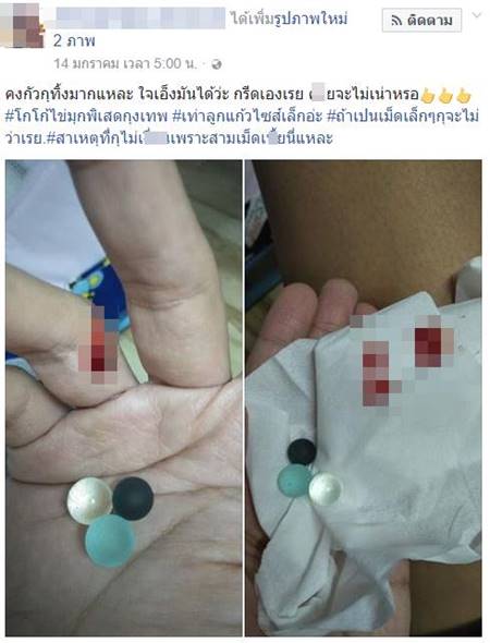 หนุ่มกรีดหนอนน้อย เอามุกออก หนุ่มกรีดหนอนน้อย เอามุกออก