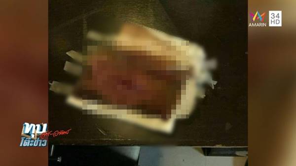 สาวผ่าตัดเสริมอึ๋ม สุดท้ายหน้าอกเน่า สาวผ่าตัดเสริมอึ๋ม สุดท้ายหน้าอกเน่า