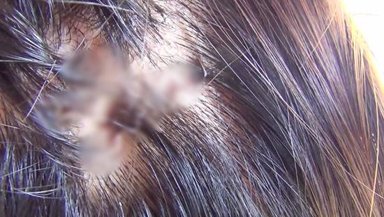 สาวร้องผ่านสื่อ ถูกพิทบูลรุมขย้ำ เย็บ 70 เข็ม ด้านเจ้าของหมาไม่ช่วยสักบาท สาวร้องผ่านสื่อ ถูกพิทบูลรุมขย้ำ เย็บ 70 เข็ม ด้านเจ้าของหมาไม่ช่วยสักบาท