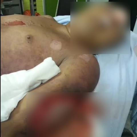 เปิดบันทึกคดีฆ่าพลทหารเบนซ์ โดนทำร้ายเหมือนไม่ใช่คน แถม ผบ.คุก ซ้ำเติมจนทรุด เปิดบันทึกคดีฆ่าพลทหารเบนซ์ โดนทำร้ายเหมือนไม่ใช่คน แถม ผบ.คุก ซ้ำเติมจนทรุด