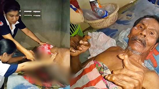 รุดช่วยเหลือ ครอบครัวสุดรันทด พิการทั้งบ้าน ดูแลกันตามมีตามเกิด รุดช่วยเหลือ ครอบครัวสุดรันทด พิการทั้งบ้าน ดูแลกันตามมีตามเกิด