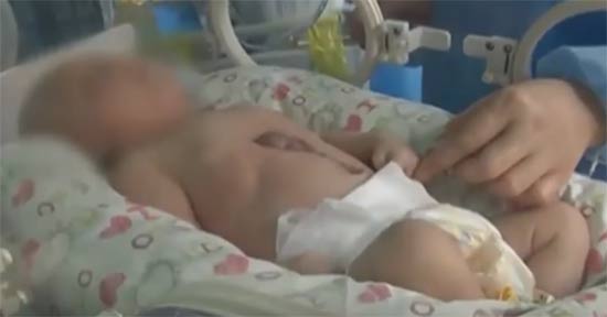 ชมคลิปหนูน้อยมีหัวใจอยู่นอกหน้าอก เต้นตุบ ๆ น่าหวาดเสียว ชมคลิปหนูน้อยมีหัวใจอยู่นอกหน้าอก เต้นตุบ ๆ น่าหวาดเสียว