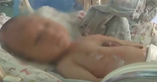 ชมคลิปหนูน้อยมีหัวใจอยู่นอกหน้าอก เต้นตุบ ๆ น่าหวาดเสียว ชมคลิปหนูน้อยมีหัวใจอยู่นอกหน้าอก เต้นตุบ ๆ น่าหวาดเสียว