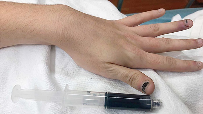 ป่วยแปลก ป่วยแปลก