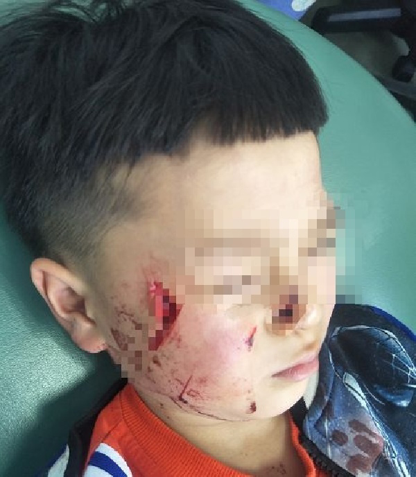 เด็กทำกระจกแตก เด็กทำกระจกแตก