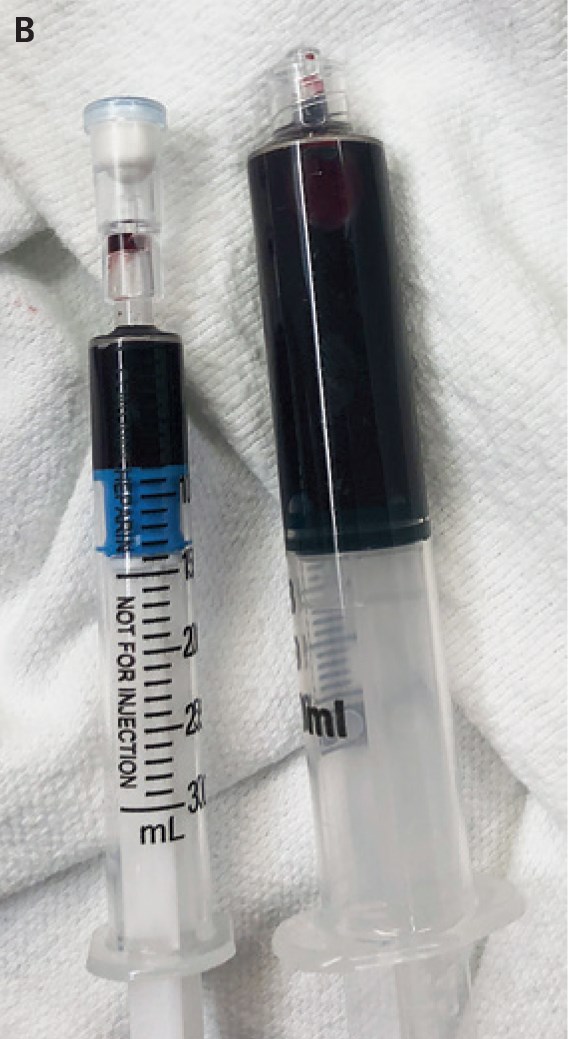 ป่วยแปลก ป่วยแปลก