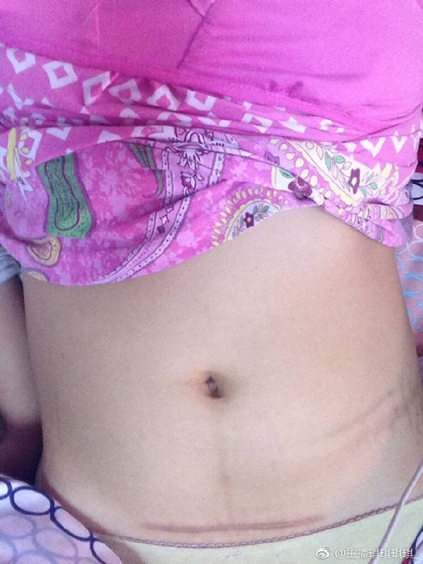 ยัดปลาไหลเป็น ๆ เข้าช่องคลอด ยัดปลาไหลเป็น ๆ เข้าช่องคลอด