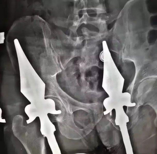 ช่างแอร์พลาดท่าพลัดตกหลังคา ช่างแอร์พลาดท่าพลัดตกหลังคา