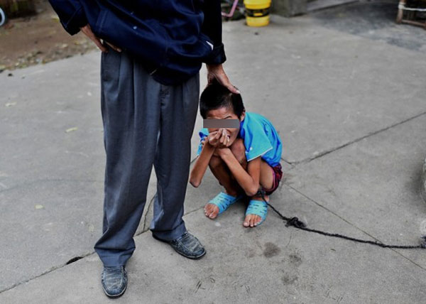 เด็กหนุ่มป่วยสมองพิการ ถูกจับล่ามนาน 10 ปี หลังครอบครัวไม่มีเงินรักษา เด็กหนุ่มป่วยสมองพิการ ถูกจับล่ามนาน 10 ปี หลังครอบครัวไม่มีเงินรักษา