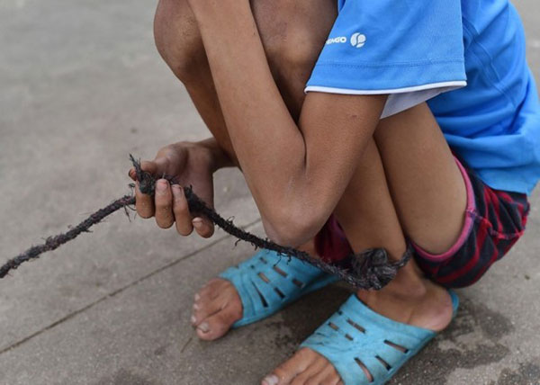 เด็กหนุ่มป่วยสมองพิการ ถูกจับล่ามนาน 10 ปี หลังครอบครัวไม่มีเงินรักษา เด็กหนุ่มป่วยสมองพิการ ถูกจับล่ามนาน 10 ปี หลังครอบครัวไม่มีเงินรักษา