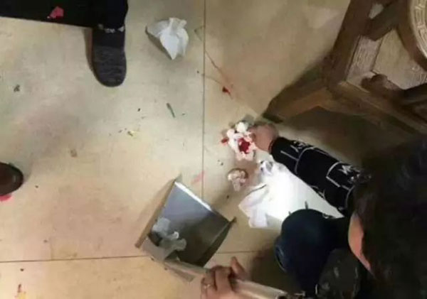 เล่นแรงไปไหม แก๊งเพื่อนคว้าค้อนทุบประตู-บุกบ้านเจ้าสาว ดุเดือดถึงขั้นได้เลือด เล่นแรงไปไหม แก๊งเพื่อนคว้าค้อนทุบประตู-บุกบ้านเจ้าสาว ดุเดือดถึงขั้นได้เลือด